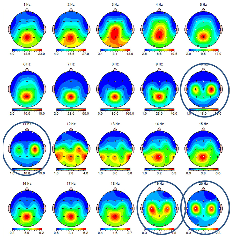 Owl Eye mu rhythm presentation